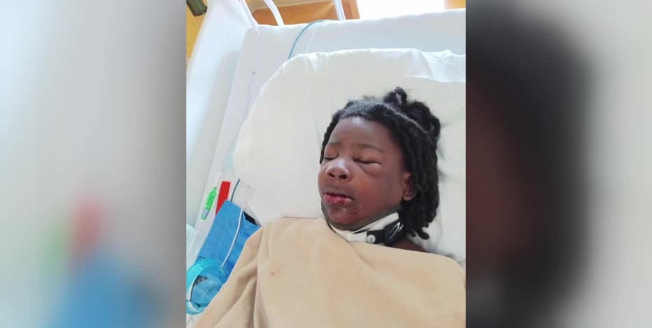 Milwaukee hit-and-run, child injured at 35th and Scott; mother wants  justice | FOX6 Milwaukee