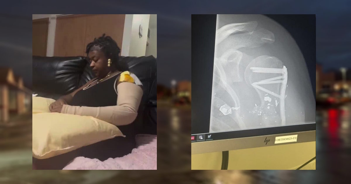 Milwaukee road rage shooting; woman speaks out after being shot | FOX6 ...