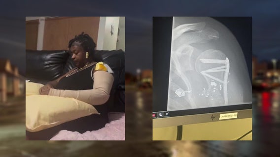 Milwaukee road rage shooting; woman speaks out after being shot