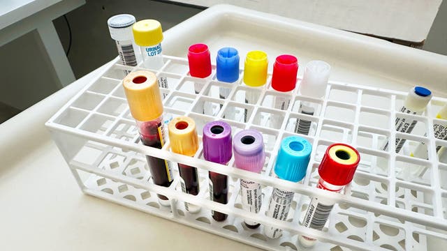 Milwaukee temporarily closes STI clinic amid staffing shortage