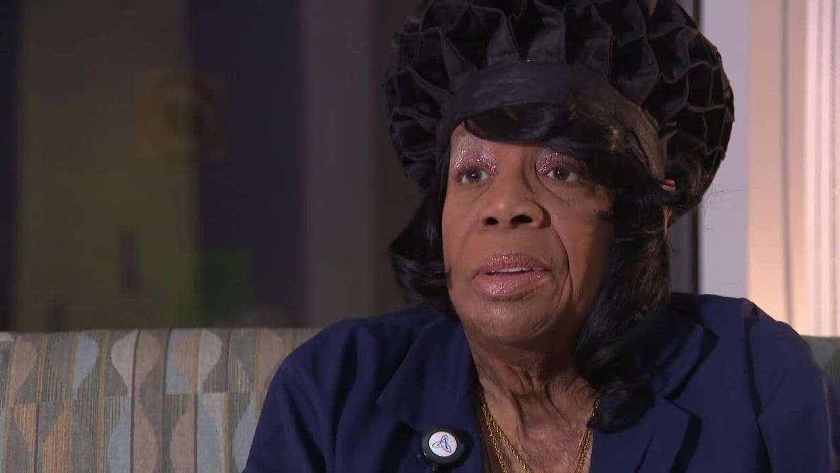 Milwaukee burn support group helps survivors heal beyond physical scars