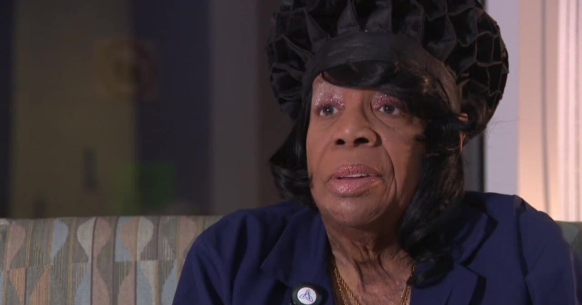 Milwaukee burn support group helps survivors heal beyond physical