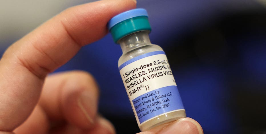 Waukesha County measles case confirmed, Wisconsin health officials say