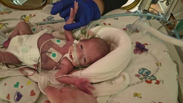 Baby heads home after 150 days in NICU; Milwaukee family shares story
