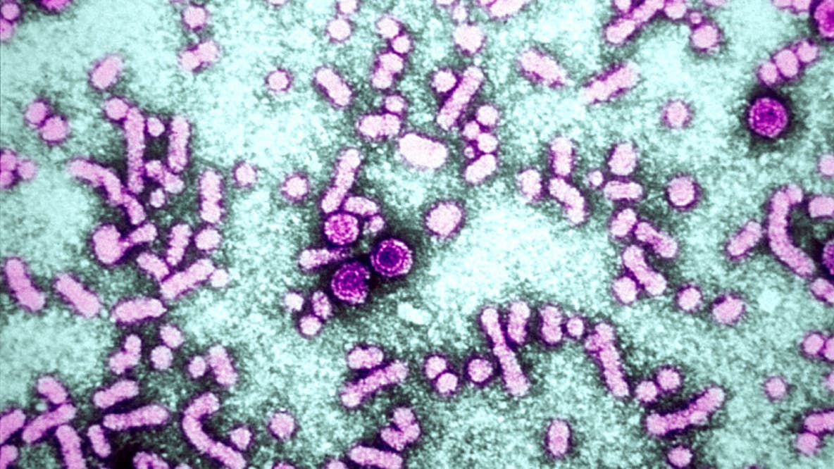 Viral hepatitis elimination plan; DHS launches dashboard to track progress