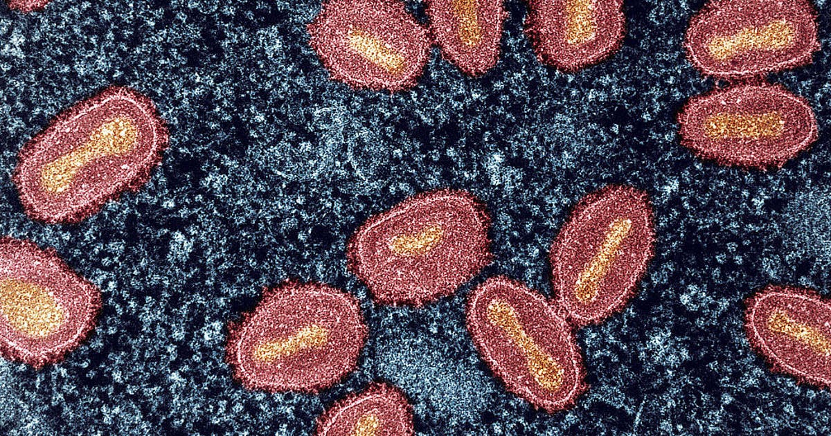Cluster of mpox cases identified in Wisconsin; prevention resources
