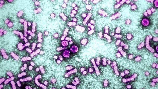 Viral hepatitis elimination plan; DHS launches dashboard to track progress