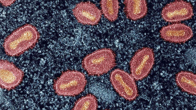 Cluster of mpox cases identified in Wisconsin; prevention resources