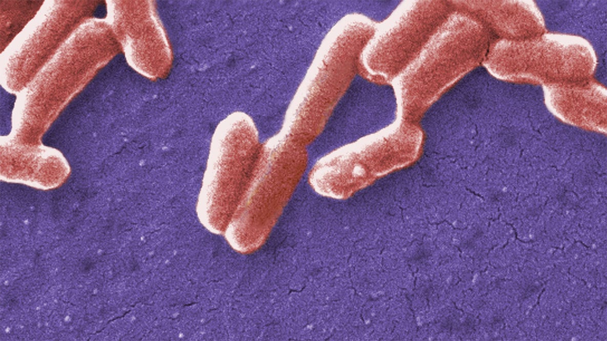 Wisconsin E. coli, Salmonella outbreak linked to alfalfa sprouts