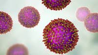 Measles in Wisconsin: 102 cases confirmed, 6 probable as of Sept. 1