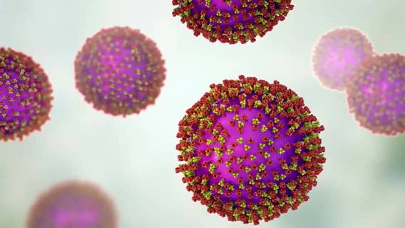 Measles in Wisconsin, cases rising as school season approaches