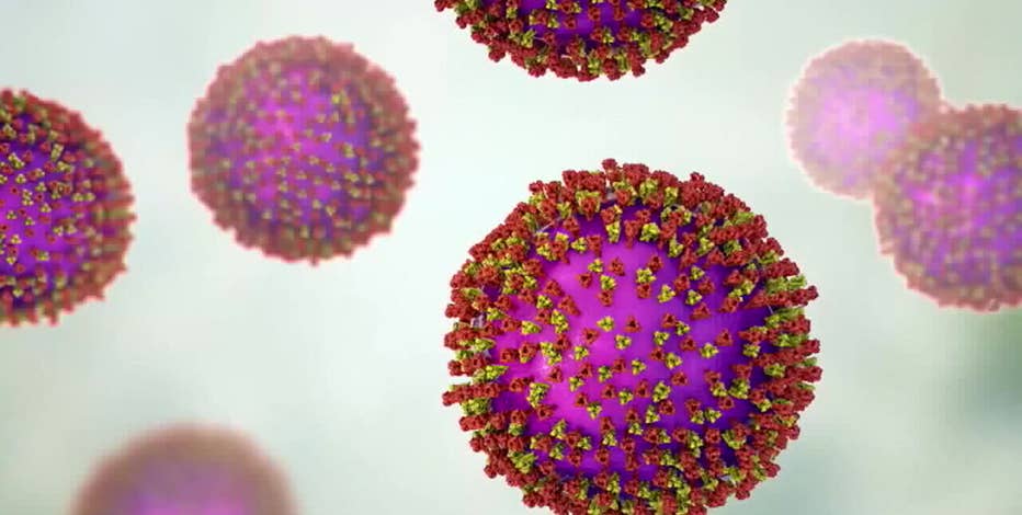 Measles in Wisconsin, cases rising as school season approaches