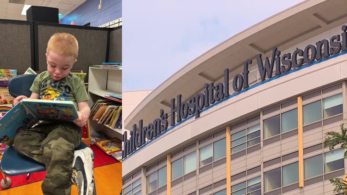 Children's Wisconsin to offer new gene therapy for Sanfilippo Type A