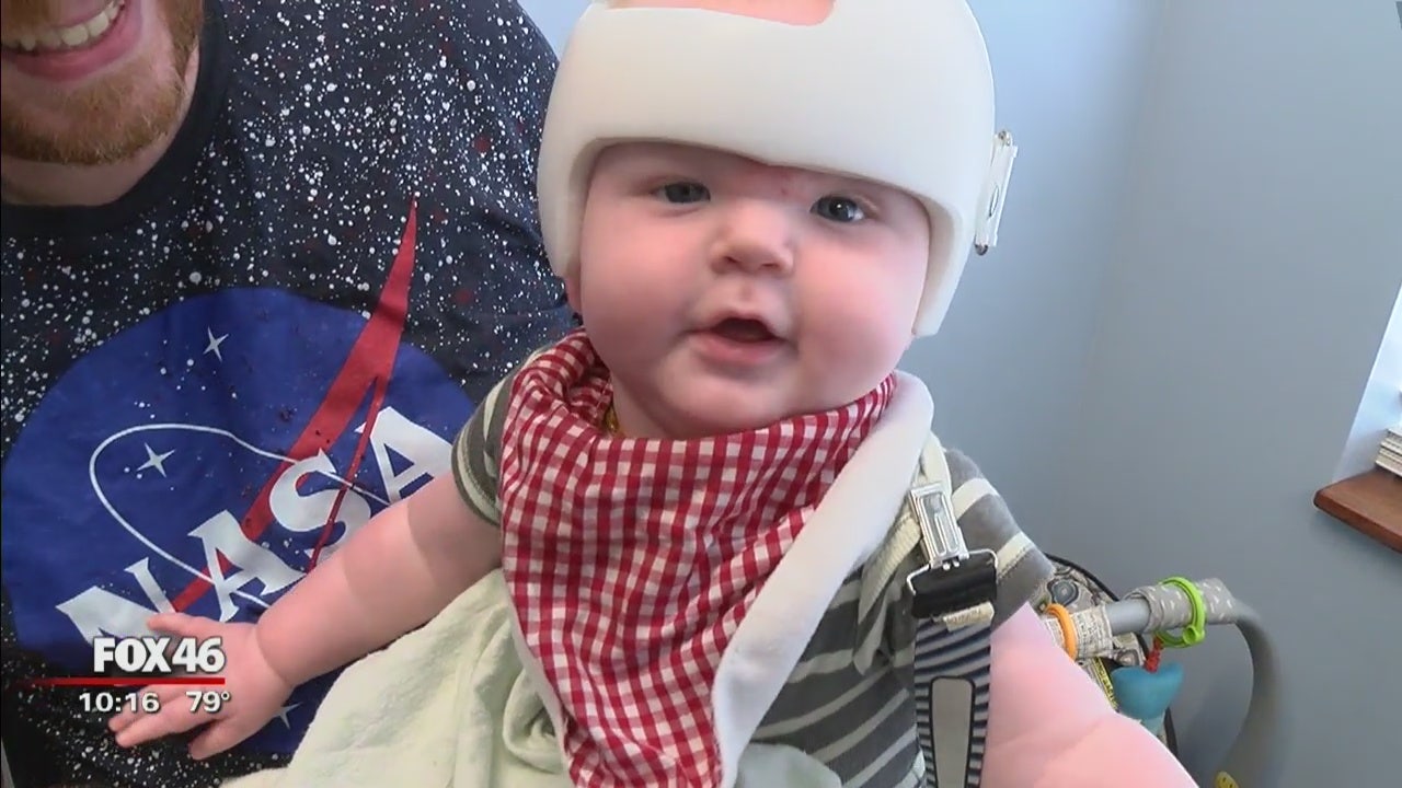 Investigation Insurance Companies Denying Cranial Helmets For Infants With Flat Head Syndrome