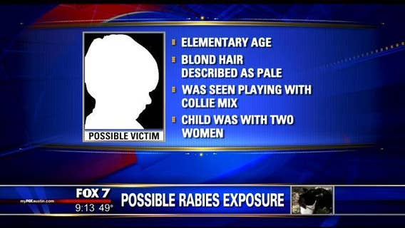 Health officials say child may have been exposed to rabid dog at Zilker Park