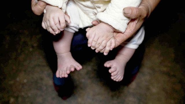 Baby born with 15 fingers and 16 toes
