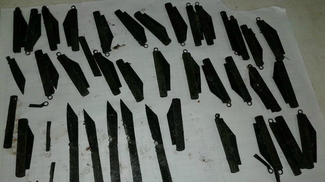 Report: Man addicted to eating metal has 40 knives removed from stomach