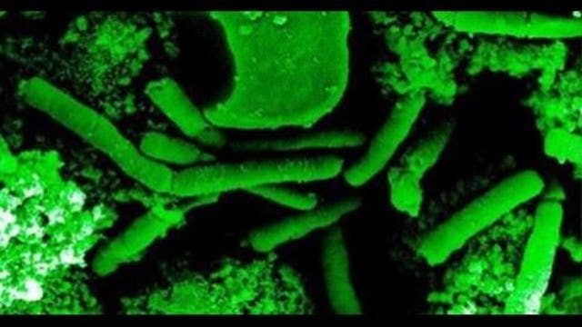 Woman contracts flesh-eating bacteria while fishing in Gulf of Mexico