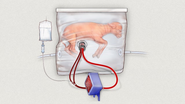 Artificial womb tested on tiny lambs