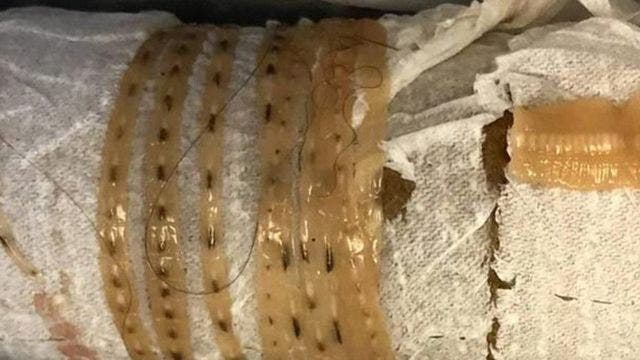 5-foot long tapeworm "wiggled out" of man's body after he ate sushi