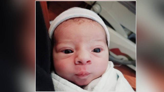 Frankenstein baby born at Florida hospital on Halloween