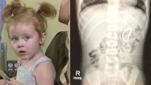 Colorado toddler swallows 28 Buckyball magnets, parents say