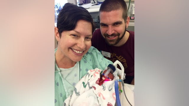 Twins will have birthdays years apart after one born on leap day