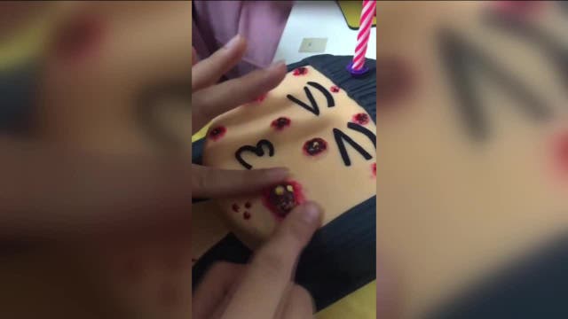 Absolutely Disgusting! Baker creates pimple-popping cake masterpieces