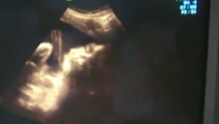cdf16059-Controversial_Texas_fetal_tissue_rules_g_0_20161129235726