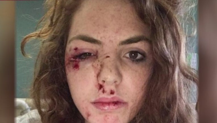 Pedicab_hit_run_0_20170317021955