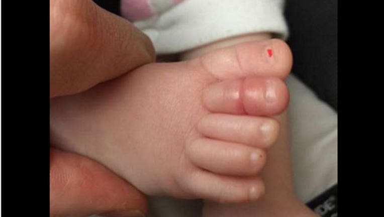 Baby toe wrapped in hair-402970