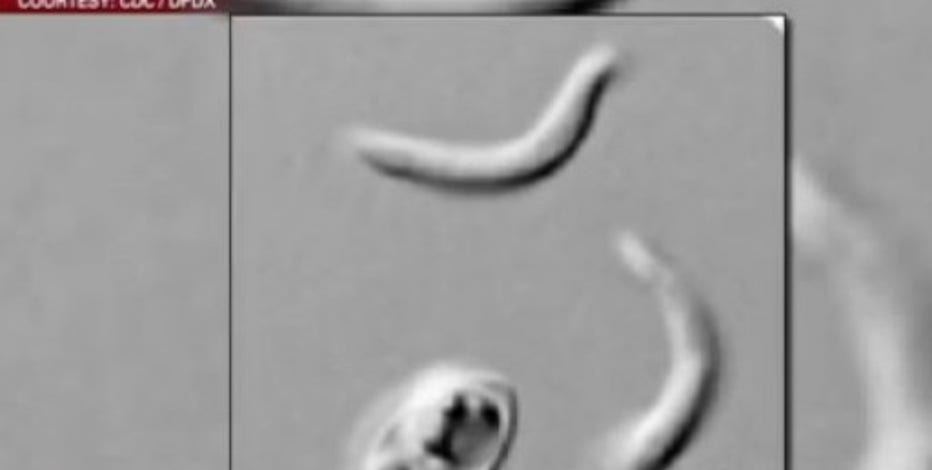 Cyclosporiasis outbreak being investigated by Austin Public Health