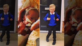 Mom celebrates premature son's first day of school after being told he would likely die