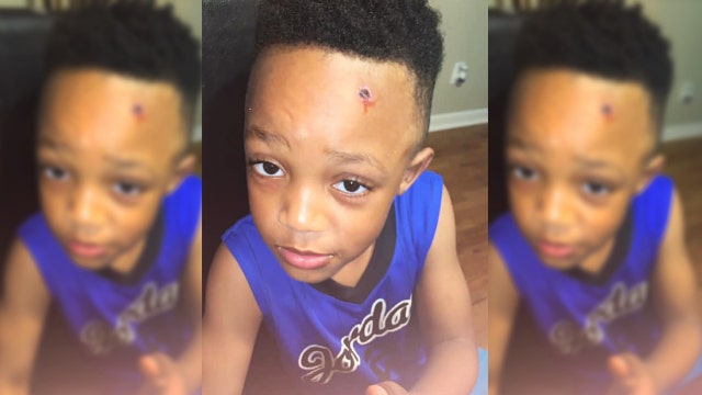 Mom horrified when son, 7, returns from school with bullet hole painted on face
