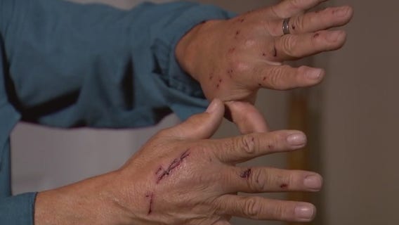 Neighbor helps save Martindale city councilwoman from vicious dog attacks