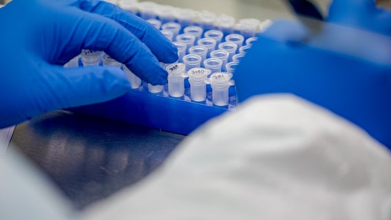 What makes the Delta Variant of COVID-19 so different?