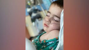 ‘How did this happen?’: Doctor shares 4-year-old son’s harrowing battle with COVID-19