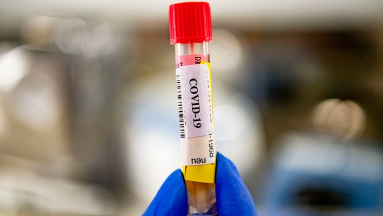 A lab technician holding a test tube that contains blood