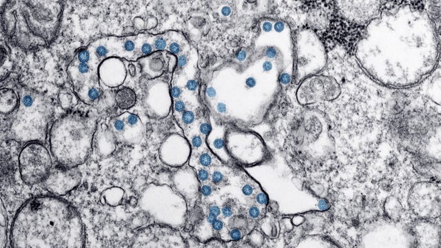 New coronavirus test is imperfect step toward mass screening