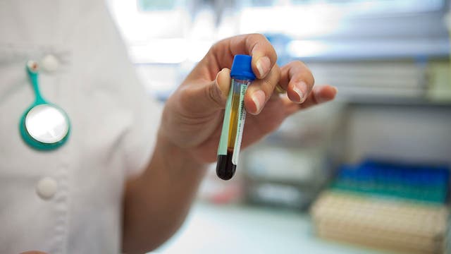 New COVID-19 testing site allows for "easy and fast" results