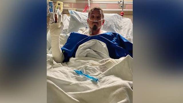 Father suffers severe burns saving children from house fire