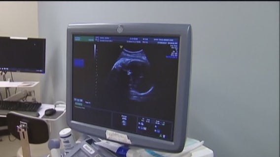 Abortion ‘heartbeat bill’ wins critical vote in Texas House