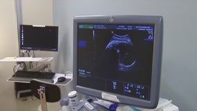 FOX 7 Discussion: Abortion providers suing to stop SB 8