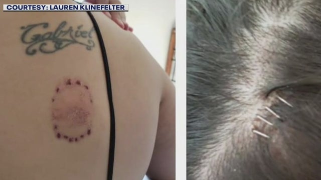 Austin woman says man who assaulted her cut off his GPS monitor
