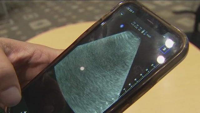 ATCEMS adding new ultrasound tech to ambulances across Austin