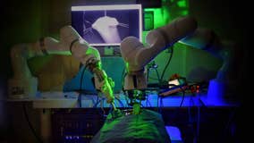 Robot performs 1st abdominal surgery without human help