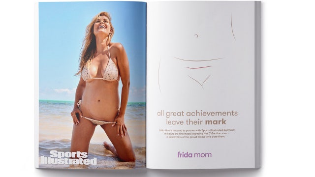 Kelly Hughes becomes 1st 'Sports Illustrated Swimsuit' model with C-section scar in magazine