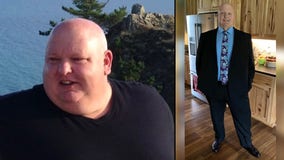Man loses 156 lbs. in 9 months with diet and exercise: ‘If I can do it, anybody can’