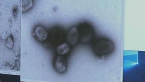US health officials warn monkeypox could mutate to resist antiviral drug Tpoxx