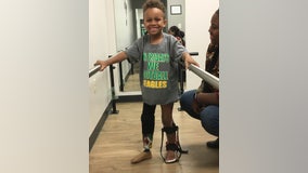 8-year-old injured in lawn mowing accident plays football after finding perfect prosthetic fit